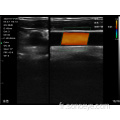 T Ultrasons sans fil Vasculaire Crosscut et sonde longitudinale